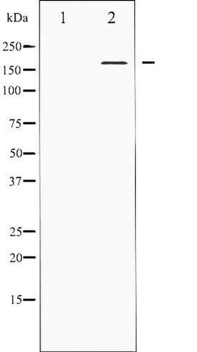 Phospho-PPAR-Binding Protein (Thr1457) Antibody in Western Blot (WB)