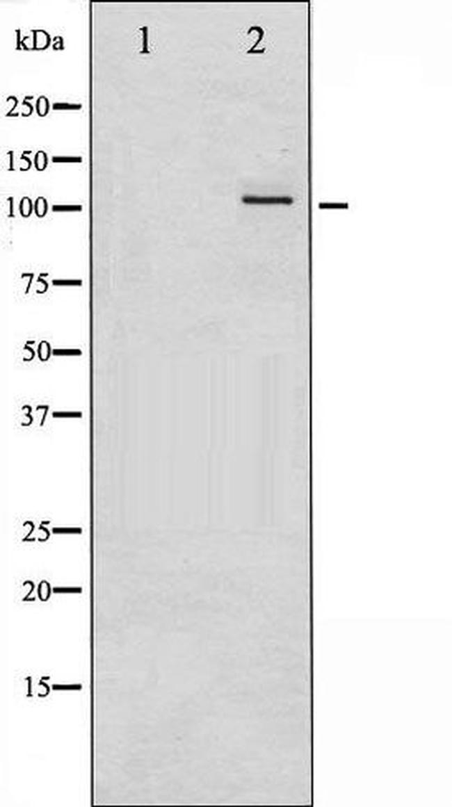 Phospho-PKD1/2/3/PKC mu (Ser738, Ser742) Antibody in Western Blot (WB)