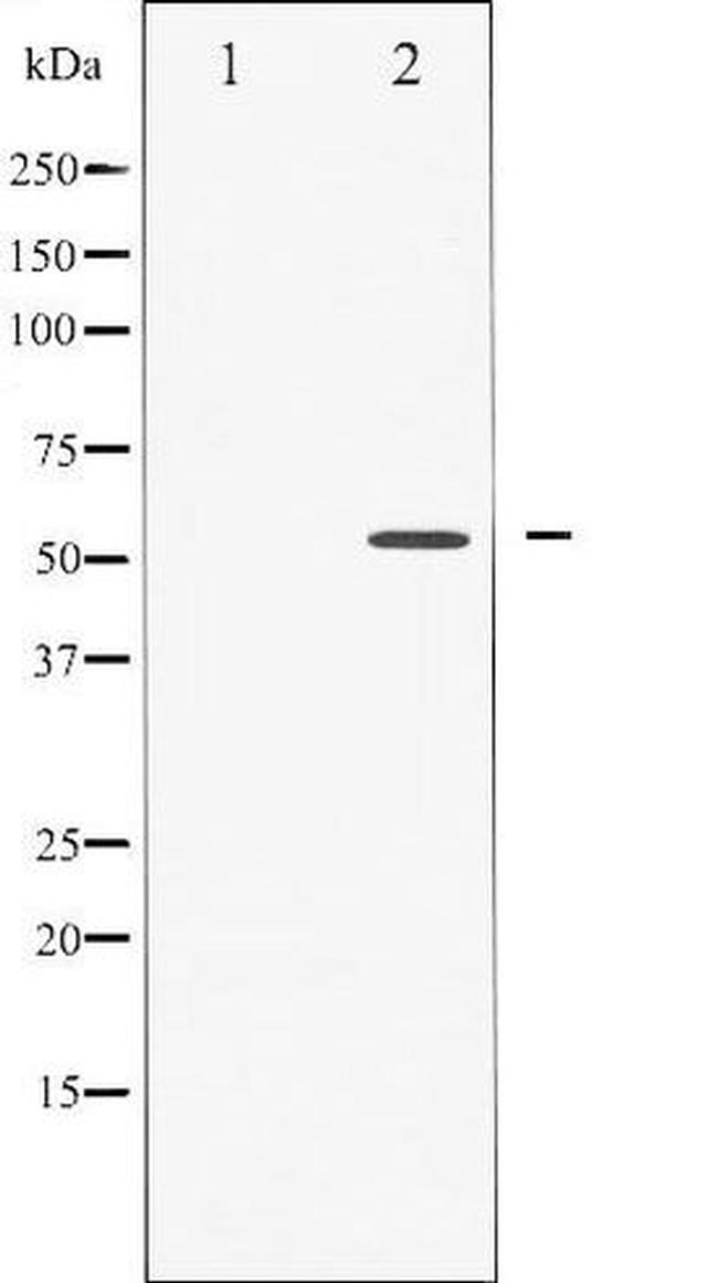 Phospho-Caspase 8 (Ser347) Antibody in Western Blot (WB)