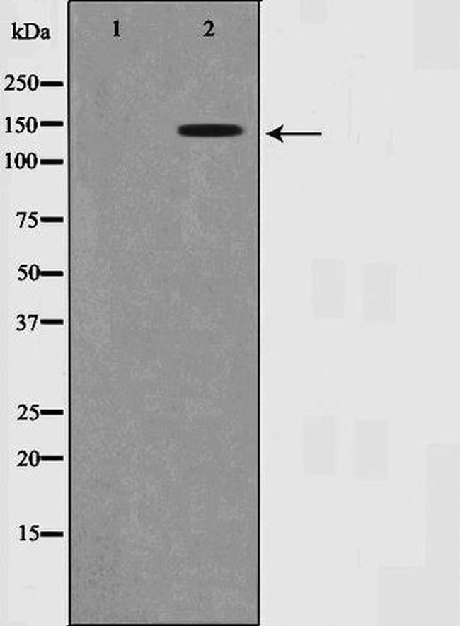 Phospho-SMC1 (Ser957) Antibody in Western Blot (WB)