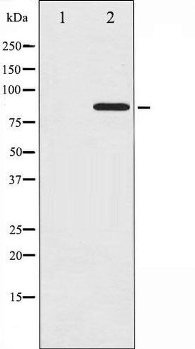 Phospho-Cortactin (Tyr466) Antibody in Western Blot (WB)