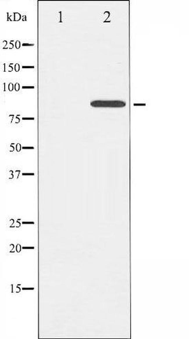 Phospho-Cortactin (Tyr421) Antibody in Western Blot (WB)