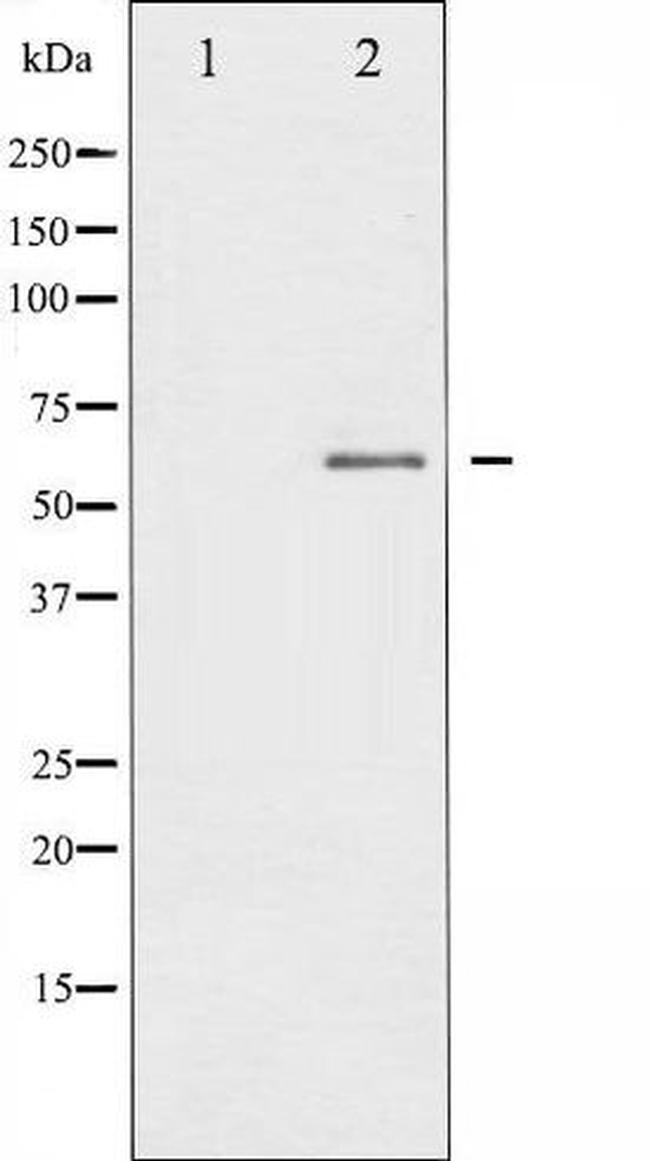 Phospho-IL10R / IL-10 Receptor alpha (Tyr496) Antibody in Western Blot (WB)