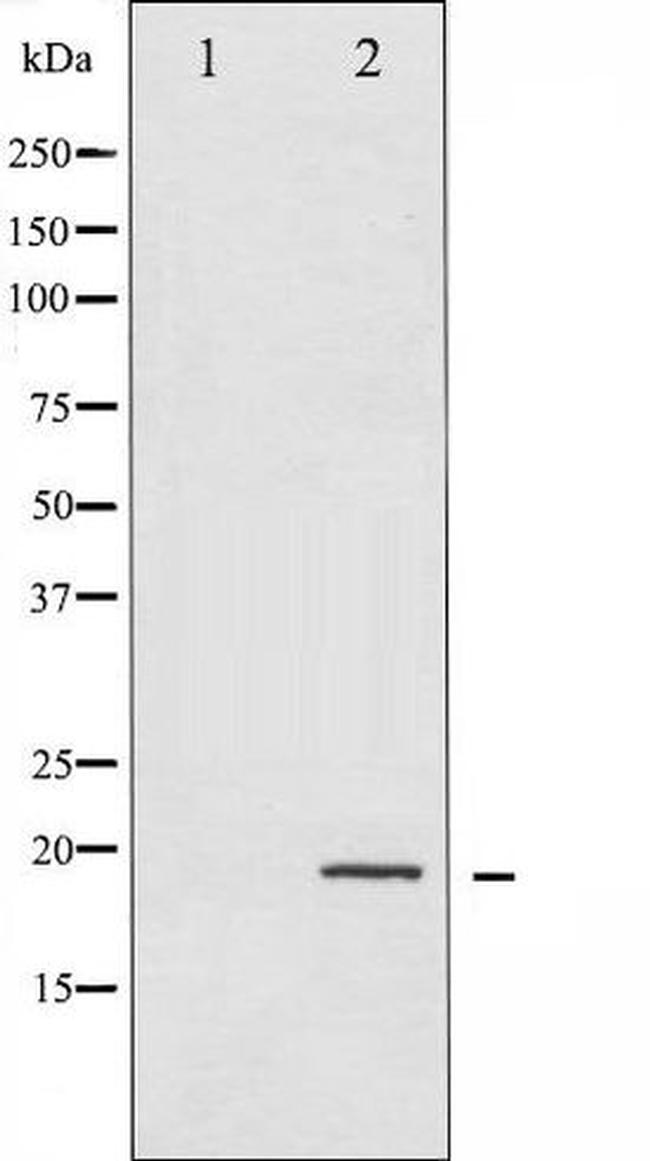 Phospho-4E-BP1 (Thr36) Antibody in Western Blot (WB)