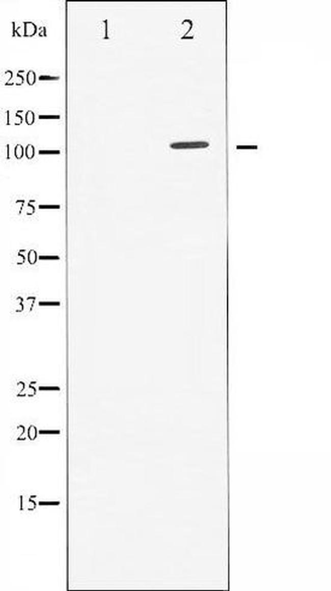 Phospho-GAB1 (Tyr627) Antibody in Western Blot (WB)
