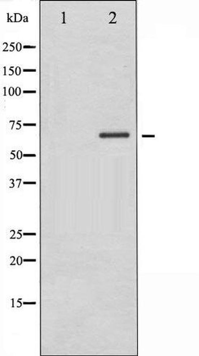 Phospho-PAK1 (Thr212) Antibody in Western Blot (WB)