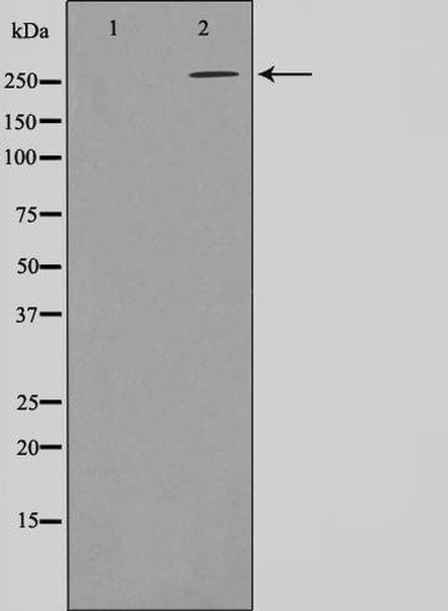 Phospho-Acetyl-CoA Carboxylase (Ser80) Antibody in Western Blot (WB)