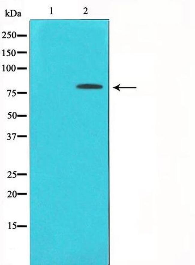 Phospho-PKC delta (Tyr313) Antibody in Western Blot (WB)