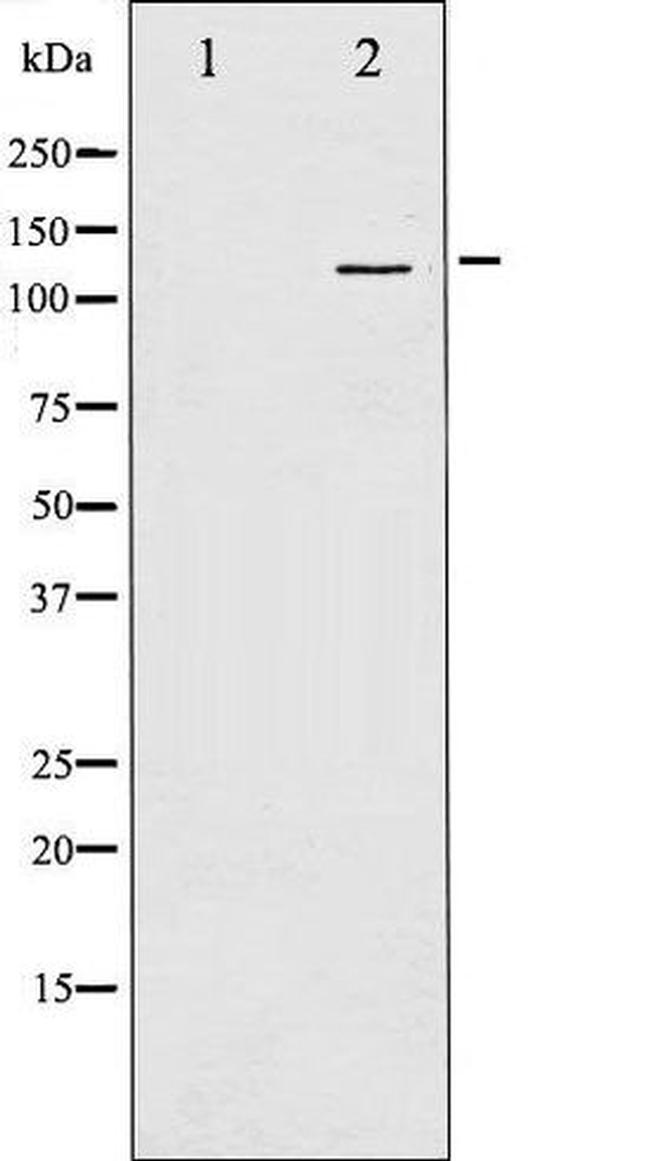Phospho-NMDA Receptor 1 (Ser897) Antibody in Western Blot (WB)