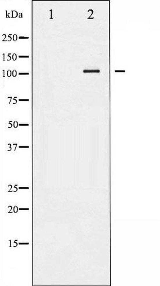 Phospho-Hormone-sensitive Lipase (Ser552) Antibody in Western Blot (WB)