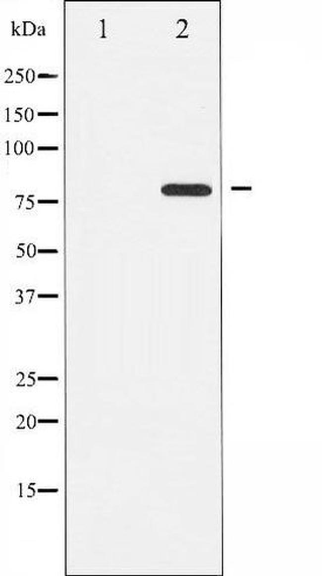 Phospho-PKC theta (Ser676) Antibody in Western Blot (WB)