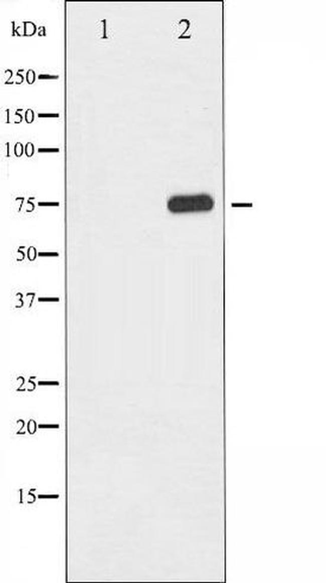 Phospho-NF-kB p65 (Thr435) Antibody in Western Blot (WB)