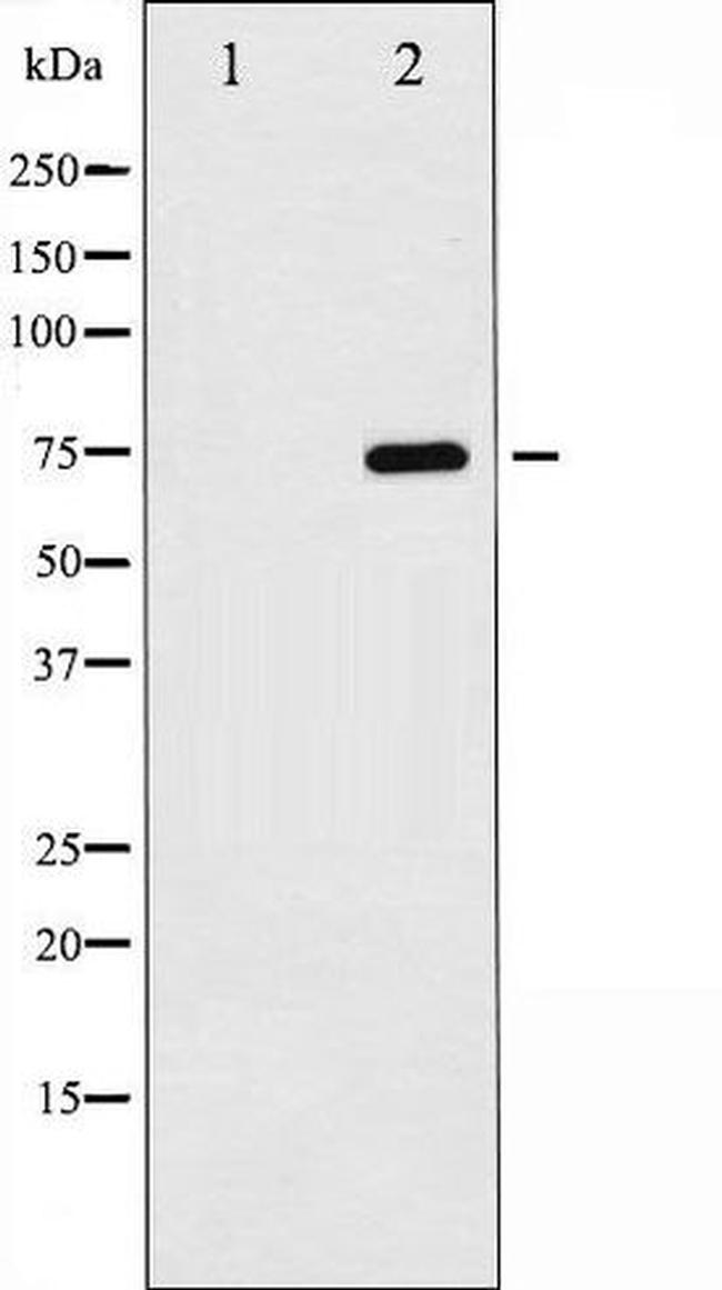 Phospho-NF-kB p65 (Ser529) Antibody in Western Blot (WB)
