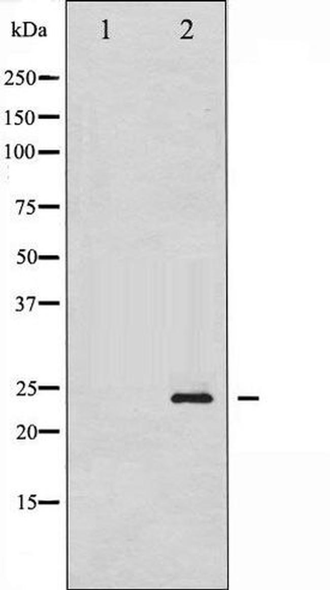 Phospho-Caveolin-1 (Tyr14) Antibody in Western Blot (WB)