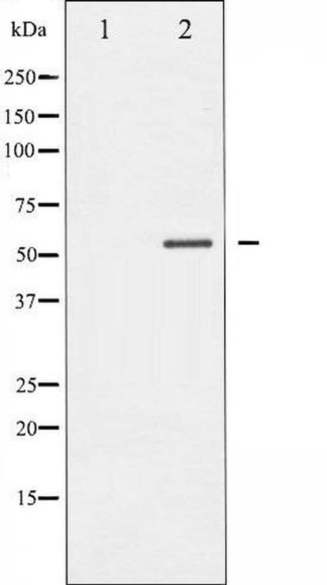 Phospho-MEF2A (Thr319) Antibody in Western Blot (WB)