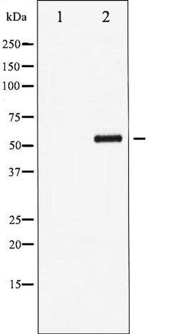 Phospho-MEF2A (Thr312) Antibody in Western Blot (WB)