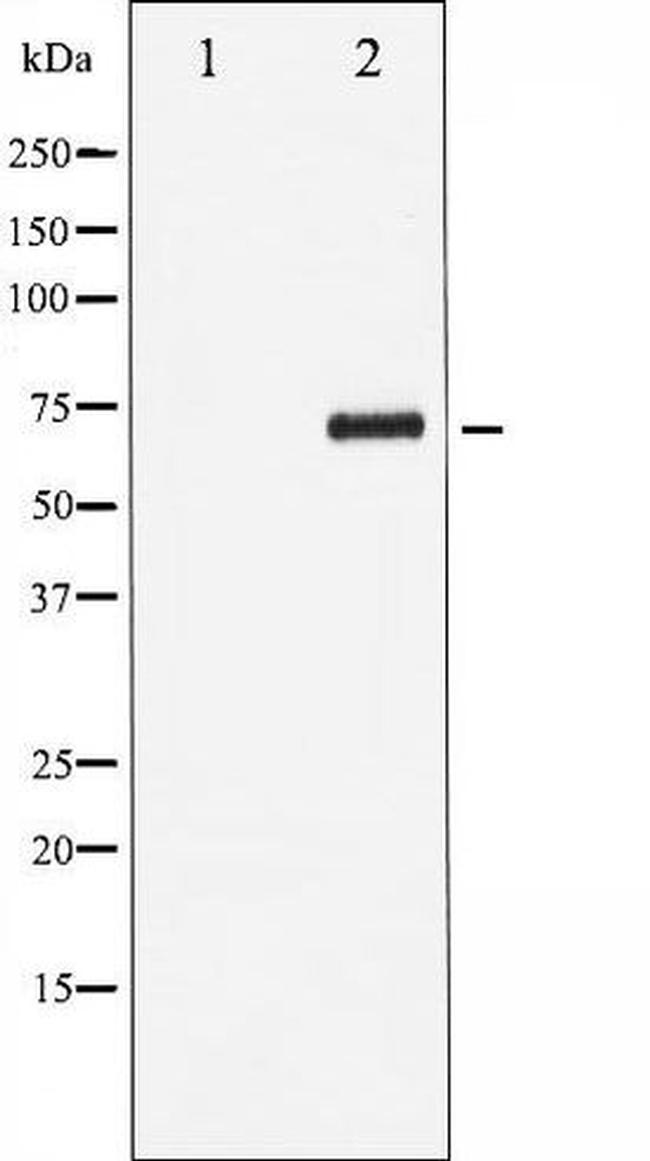 Phospho-RelB (Ser552) Antibody in Western Blot (WB)