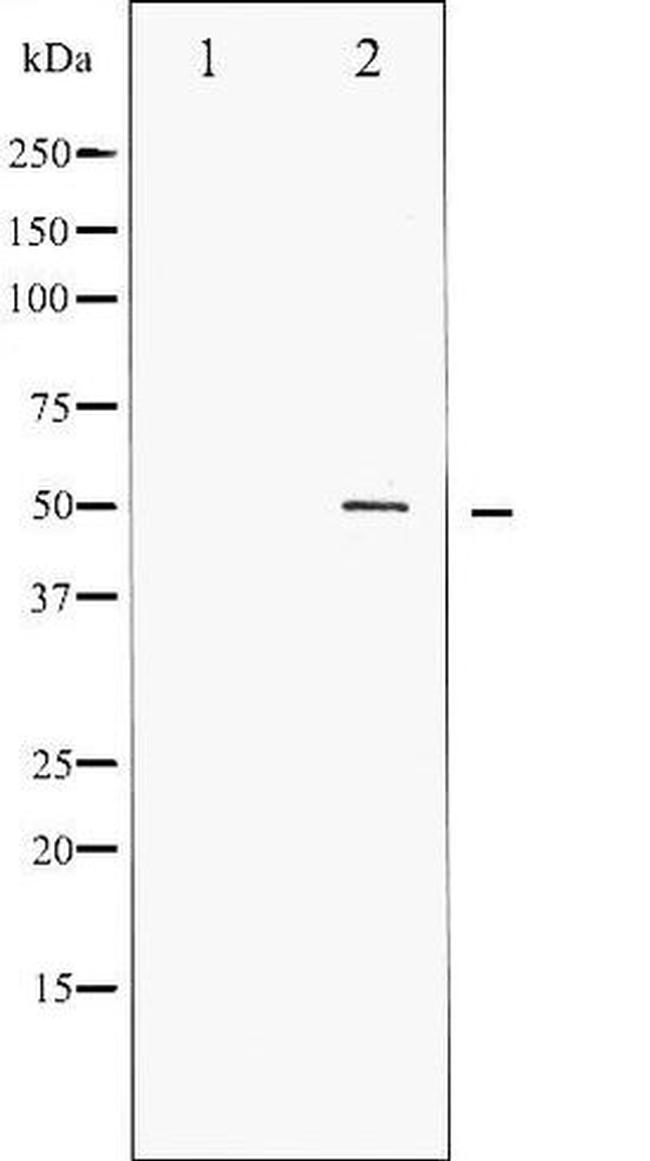 Phospho-RUNX1 / AML1 (Ser276) Antibody in Western Blot (WB)