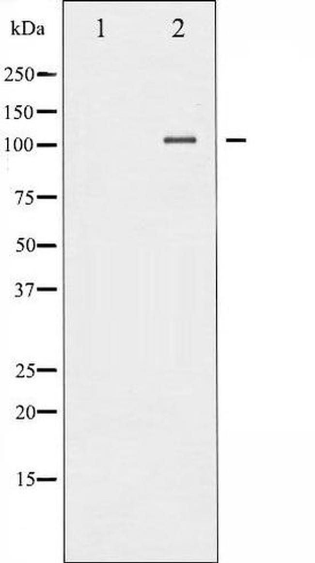 Phospho-NFkB p52 (Ser869) Antibody in Western Blot (WB)