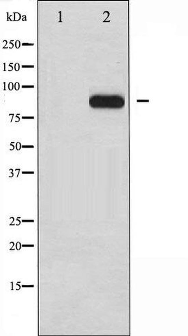 Phospho-HSF1 / Heat Shock Factor 1 (Ser303) Antibody in Western Blot (WB)