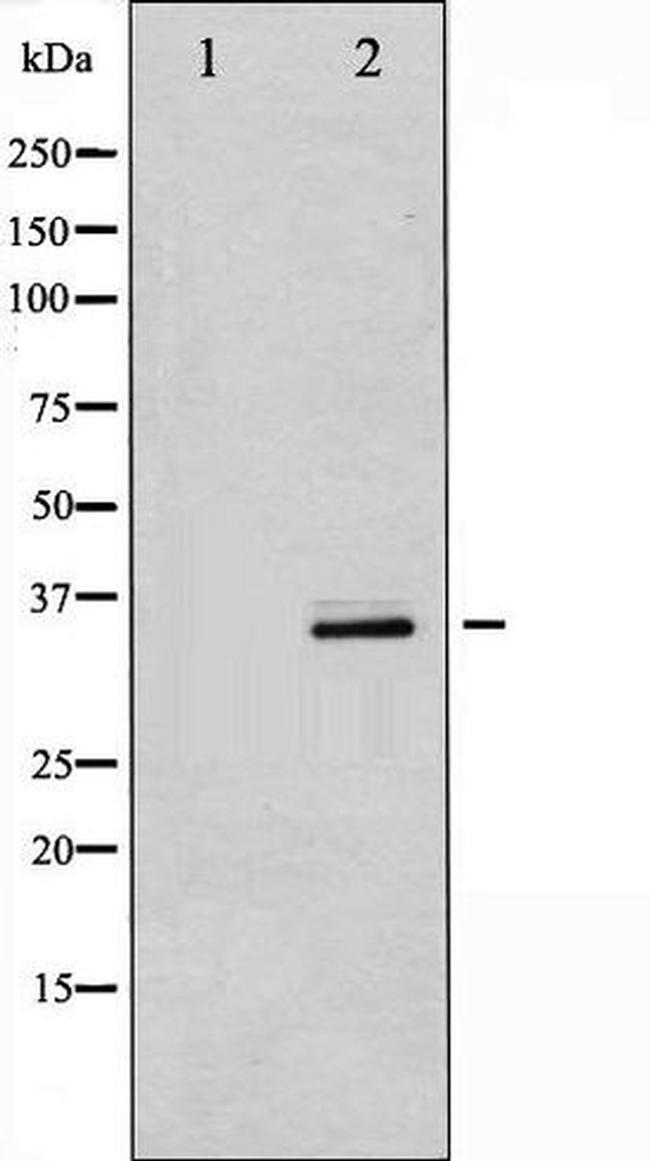 Phospho-Cdk5 (Tyr15) Antibody in Western Blot (WB)
