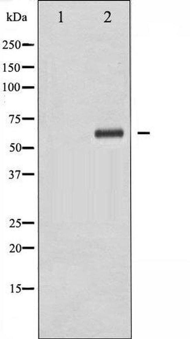 Phospho-XIAP / BIRC4 (Ser87) Antibody in Western Blot (WB)