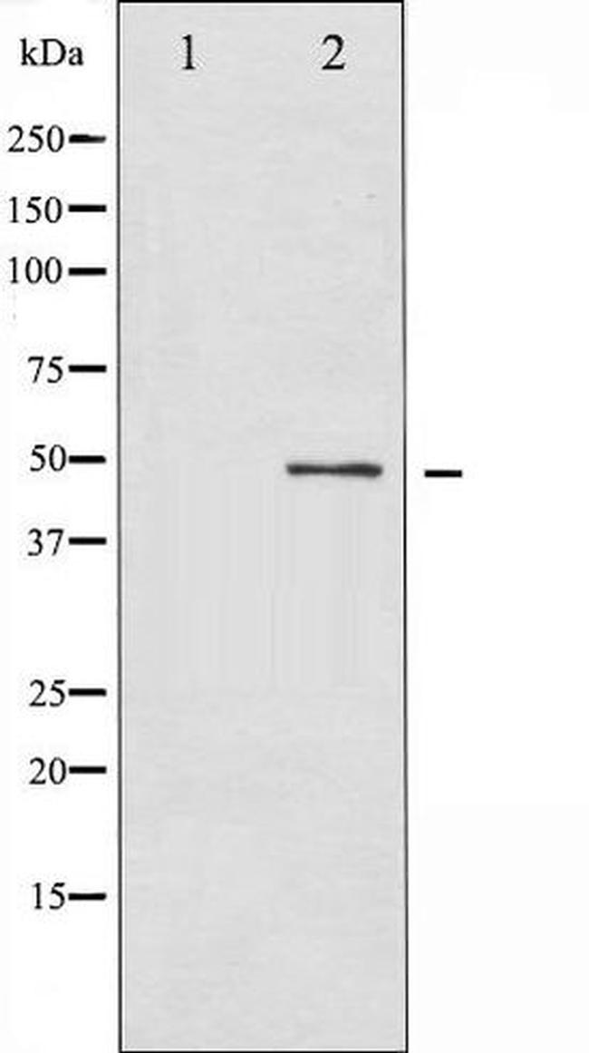 Phospho-SMAD3 (Thr179) Antibody in Western Blot (WB)