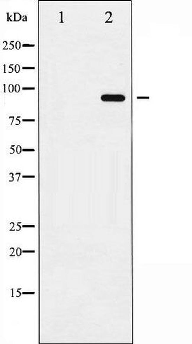 Phospho-CD156b/ADAM17 (Thr735) Antibody in Western Blot (WB)