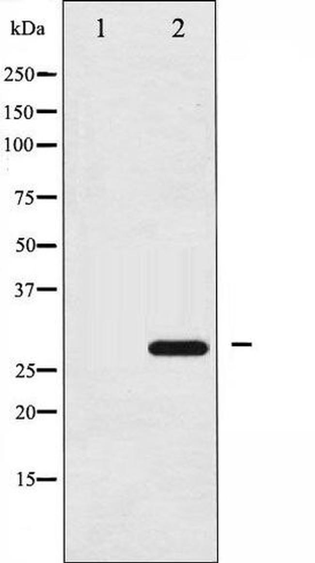 Phospho-14-3-3 zeta (Ser58) Antibody in Western Blot (WB)