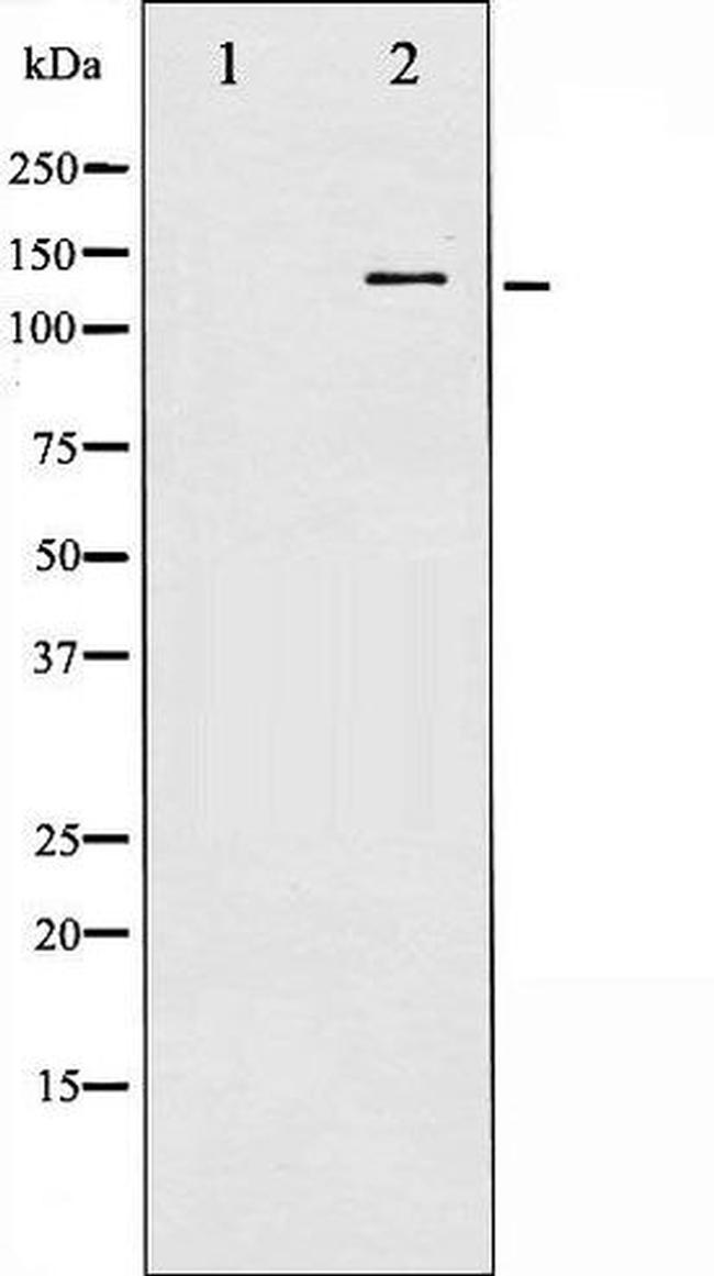 Phospho-p130 Cas / BCAR1 (Tyr410) Antibody in Western Blot (WB)