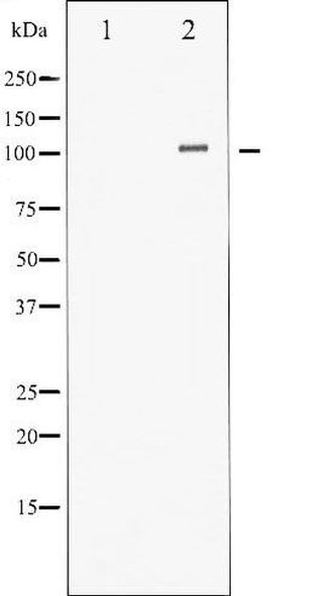 Phospho-HDAC4 (Ser632) Antibody in Western Blot (WB)