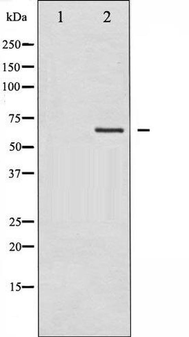 Phospho-LIM Kinase 2 (Ser283) Antibody in Western Blot (WB)