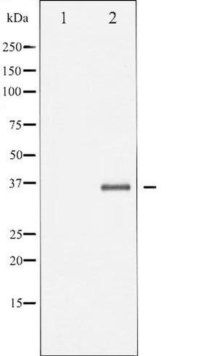Phospho-EFNB1 + EFNB2 (Tyr330) Antibody in Western Blot (WB)