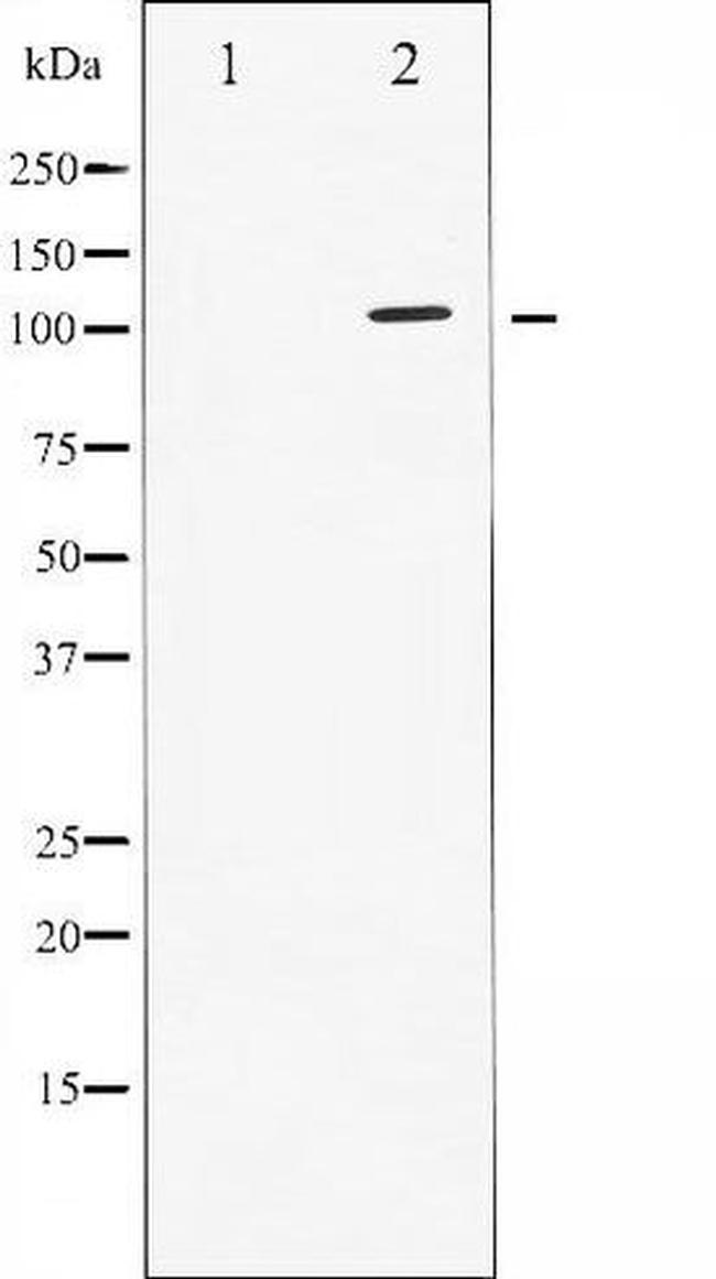 Phospho-STAT2 (Tyr690) Antibody in Western Blot (WB)