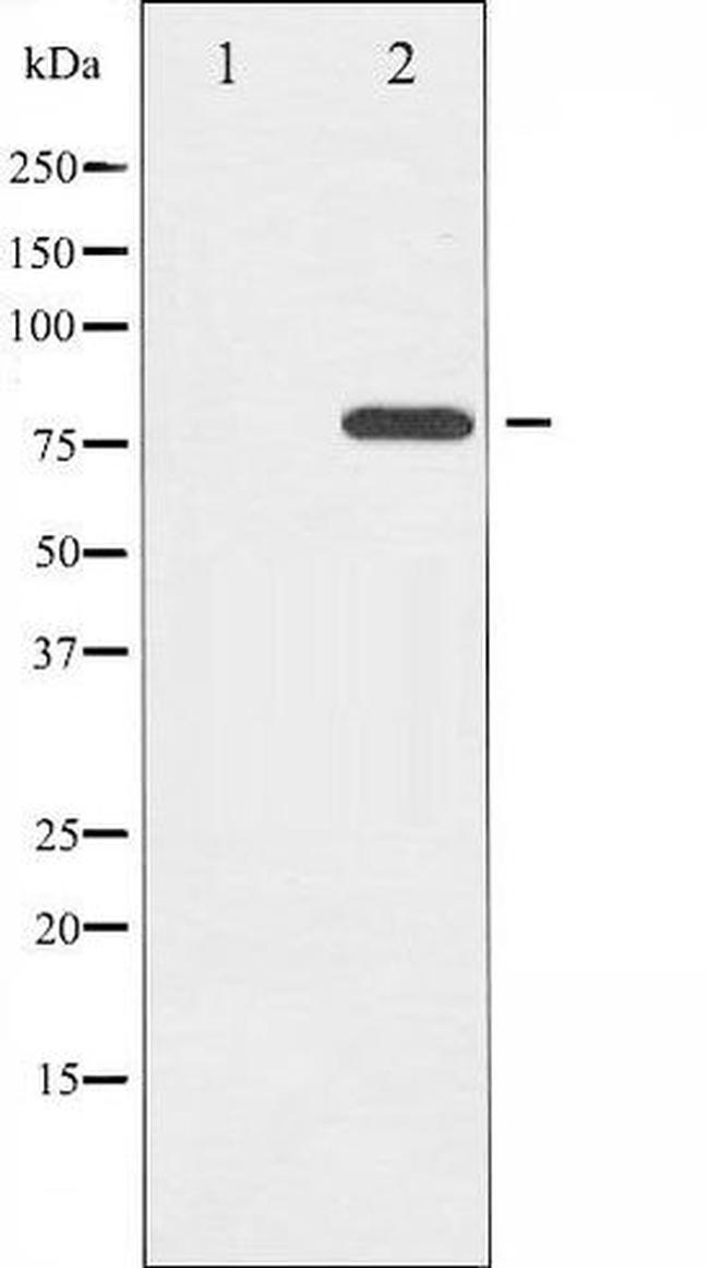 Phospho-Etk / BMX (Tyr566) Antibody in Western Blot (WB)