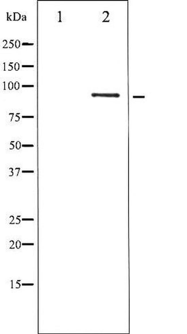 Phospho-STAT5 beta (Ser731) Antibody in Western Blot (WB)