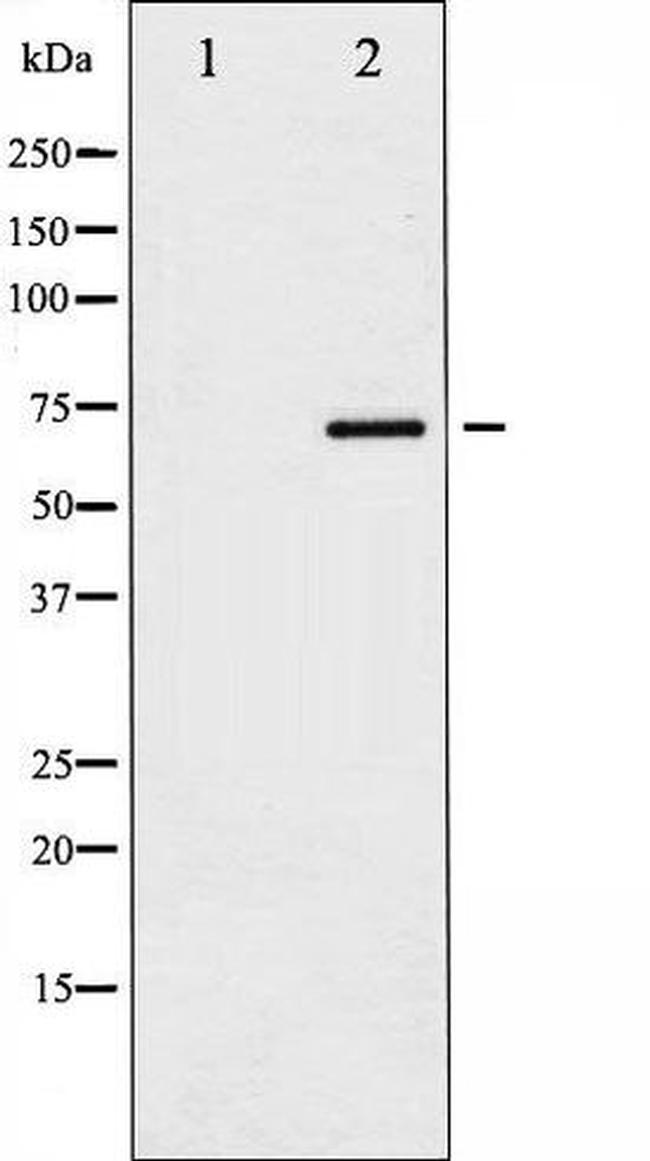 Phospho-Paxillin (Tyr118) Antibody in Western Blot (WB)
