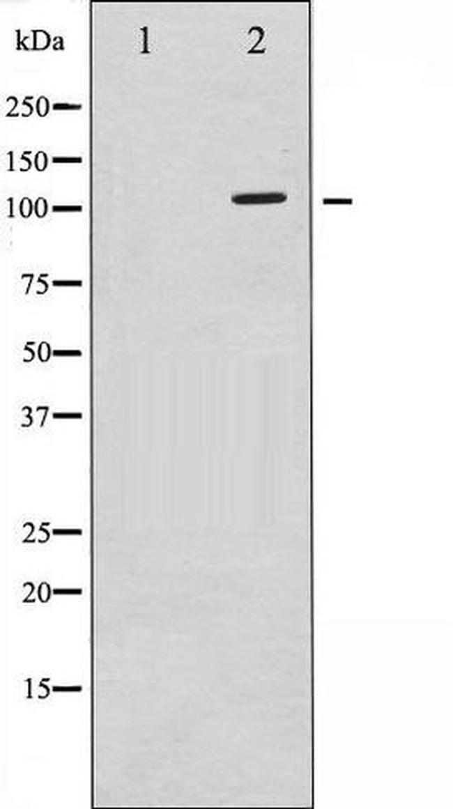 Phospho-c-PLA2 (Ser505) Antibody in Western Blot (WB)