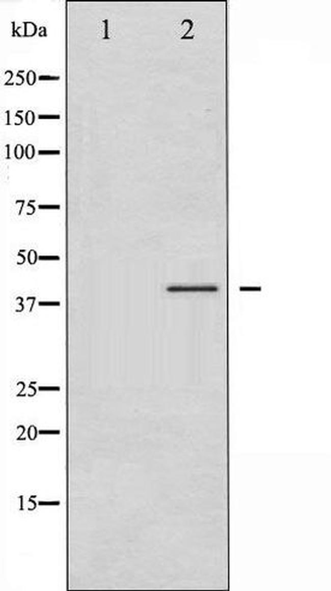 Phospho-CrkII (Tyr221) Antibody in Western Blot (WB)