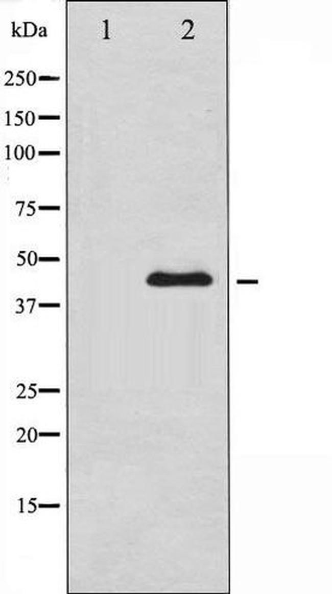 Phospho-GATA4 (Ser105) Antibody in Western Blot (WB)