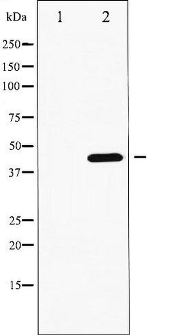 Phospho-GATA4 (Ser262) Antibody in Western Blot (WB)