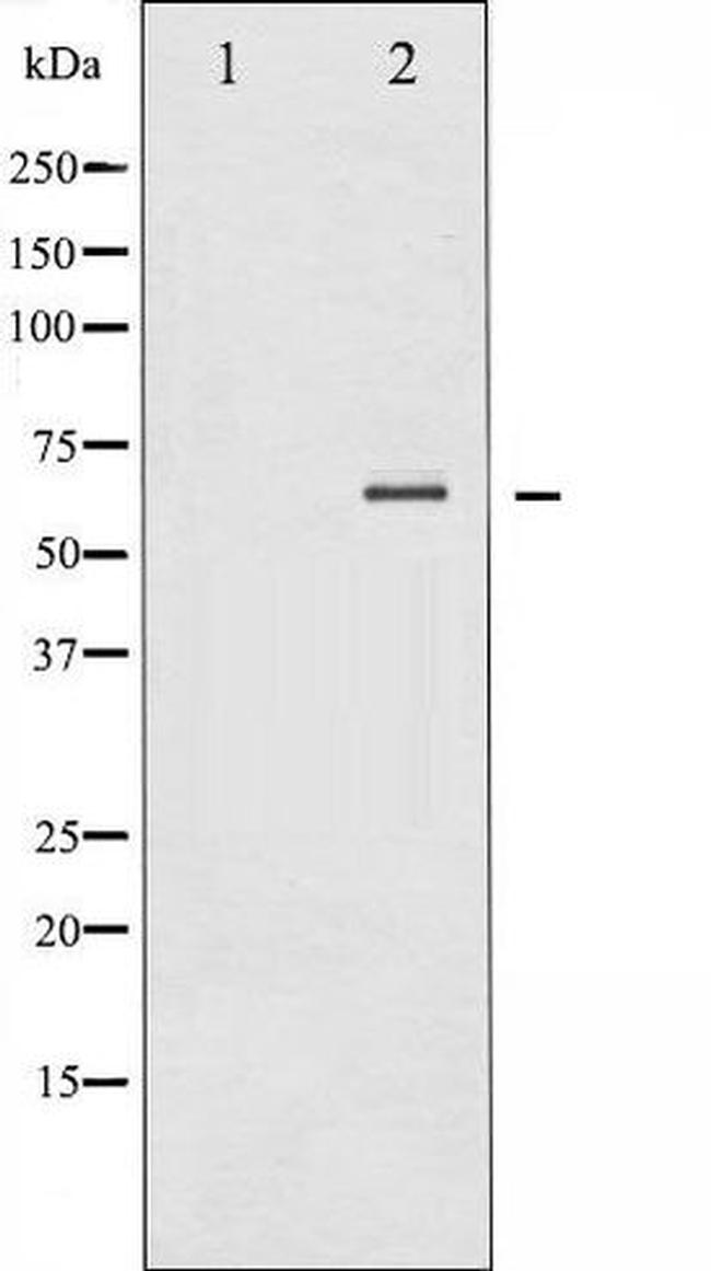 Phospho-SYK (Tyr348) Antibody in Western Blot (WB)
