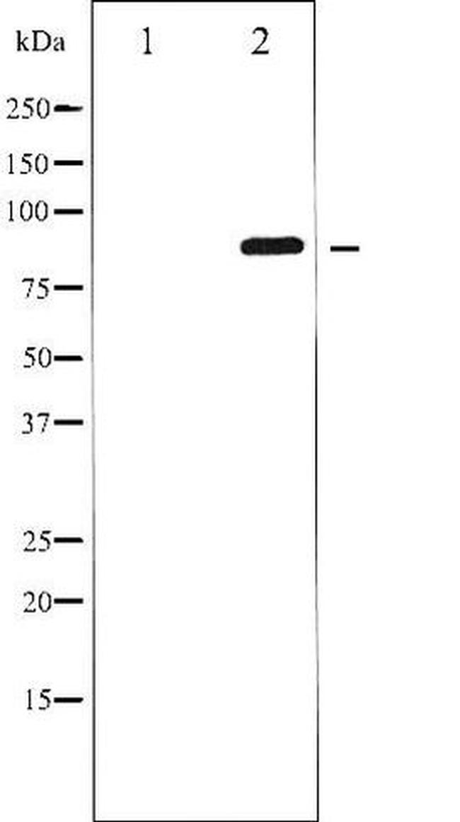 Phospho-GluR2 (Ser880) Antibody in Western Blot (WB)