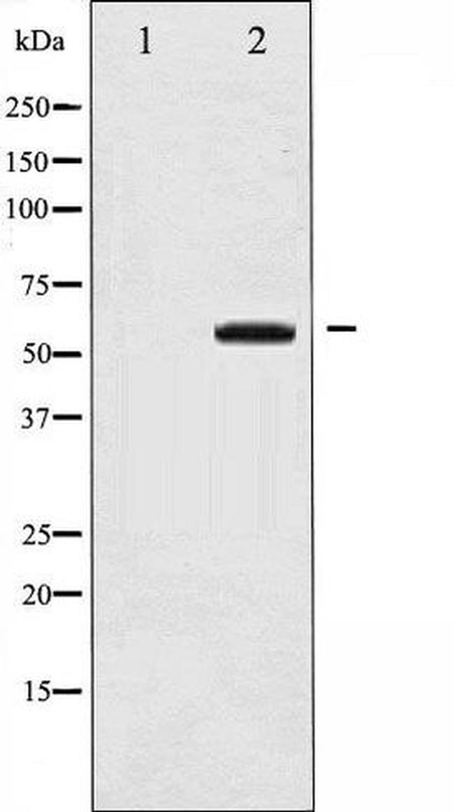 Phospho-COT/TPL-2 (Thr290) Antibody in Western Blot (WB)