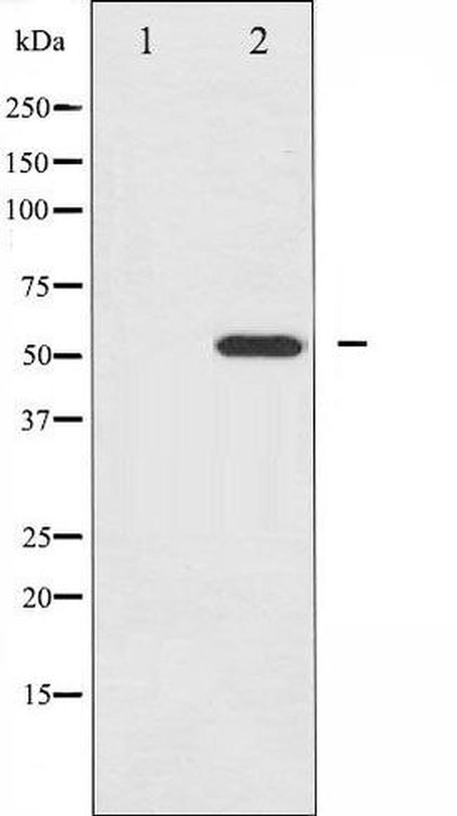 Phospho-HNF4 alpha (Ser313) Antibody in Western Blot (WB)