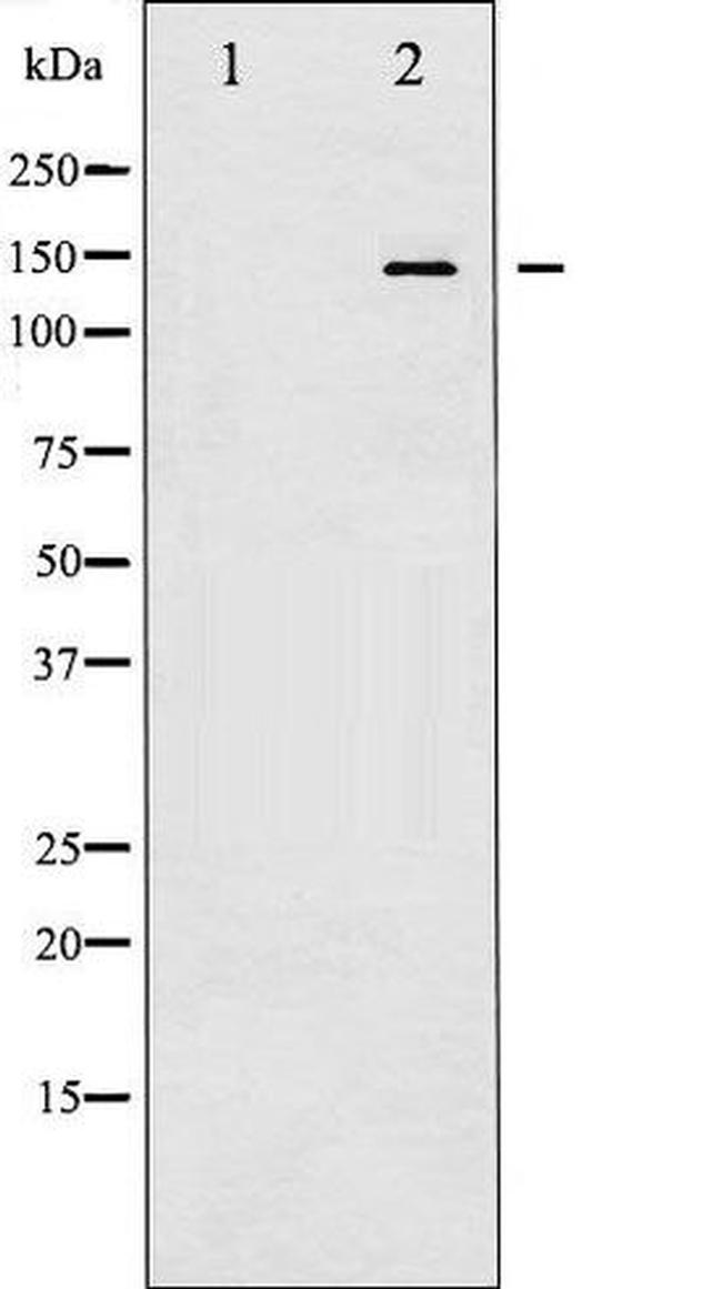 Phospho-Calcium Sensing Receptor (Thr888) Antibody in Western Blot (WB)