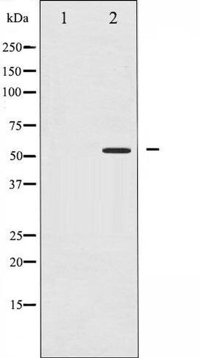 Phospho-PPAR-gamma (Ser112) Antibody in Western Blot (WB)