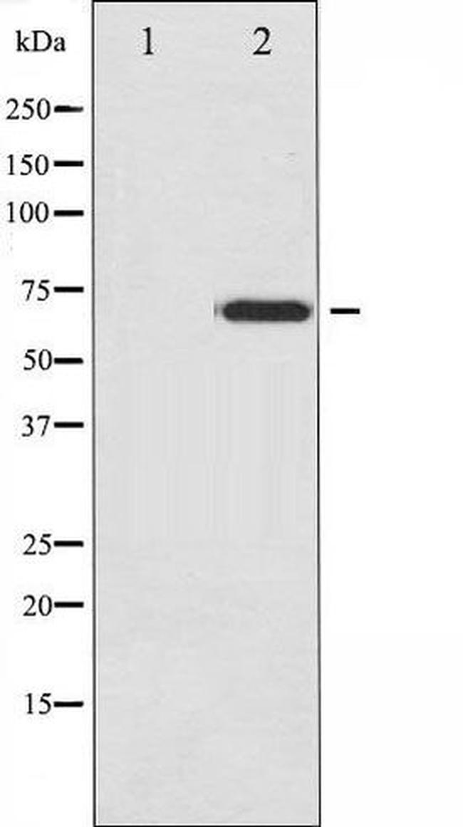 Phospho-NF2 / Merlin (Ser518) Antibody in Western Blot (WB)