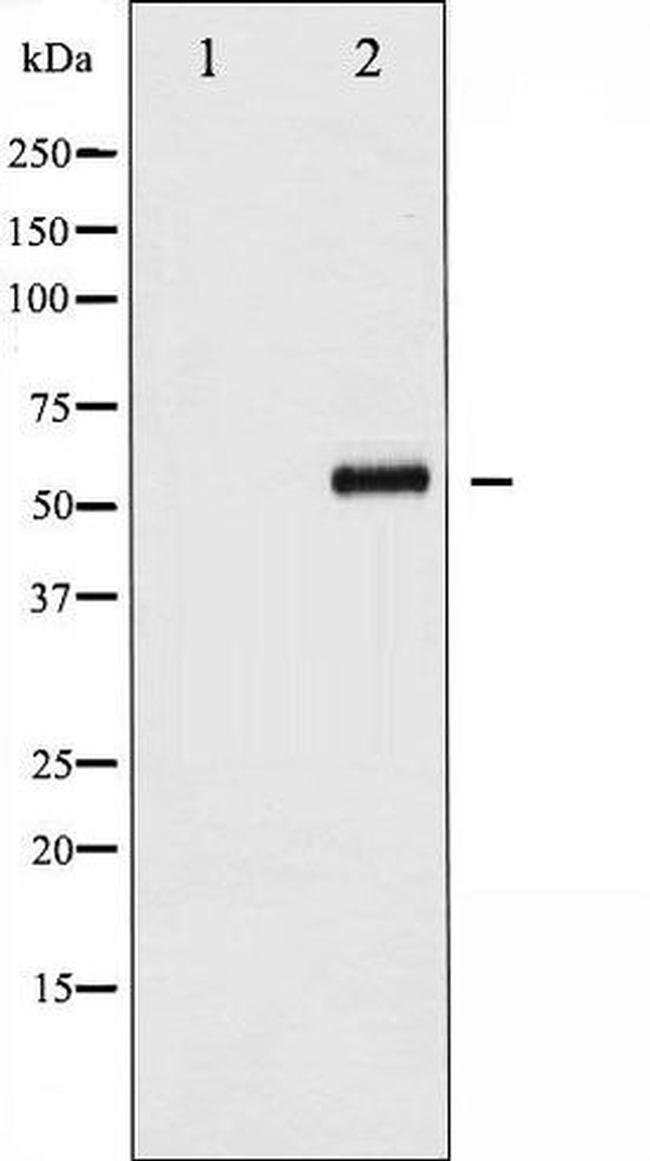 Phospho-Cdc25B (Ser353) Antibody in Western Blot (WB)