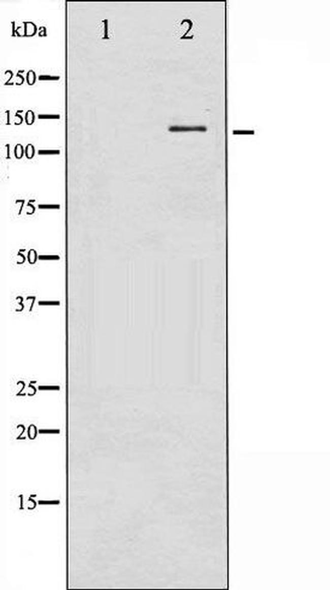 Phospho-nNOS (Ser852) Antibody in Western Blot (WB)